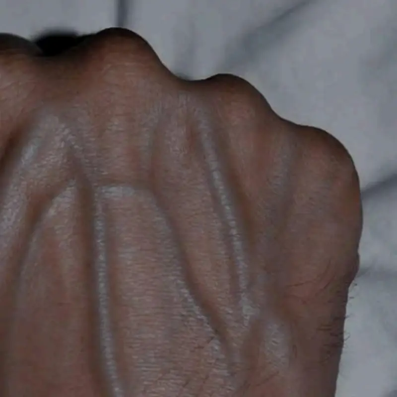 If Your Hand Veins Are Visible, Here’s What Your Body May Be Telling You