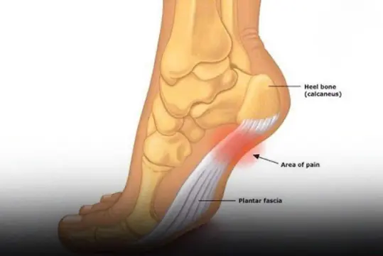 If Your Legs Often Feel Numb, Here’s What You Should Know