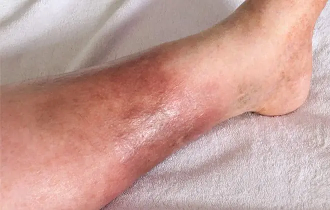 The Hidden Consequences of Sleeping With… That No One Talks About