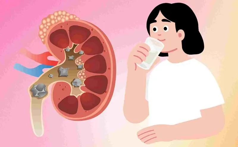 Watch Out for These 5 Signs That Your Kidneys May Not Be Working Properly