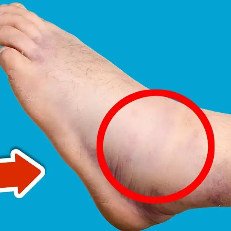 The 5 Best Nutrients to Help Reduce Swelling in Feet and Legs