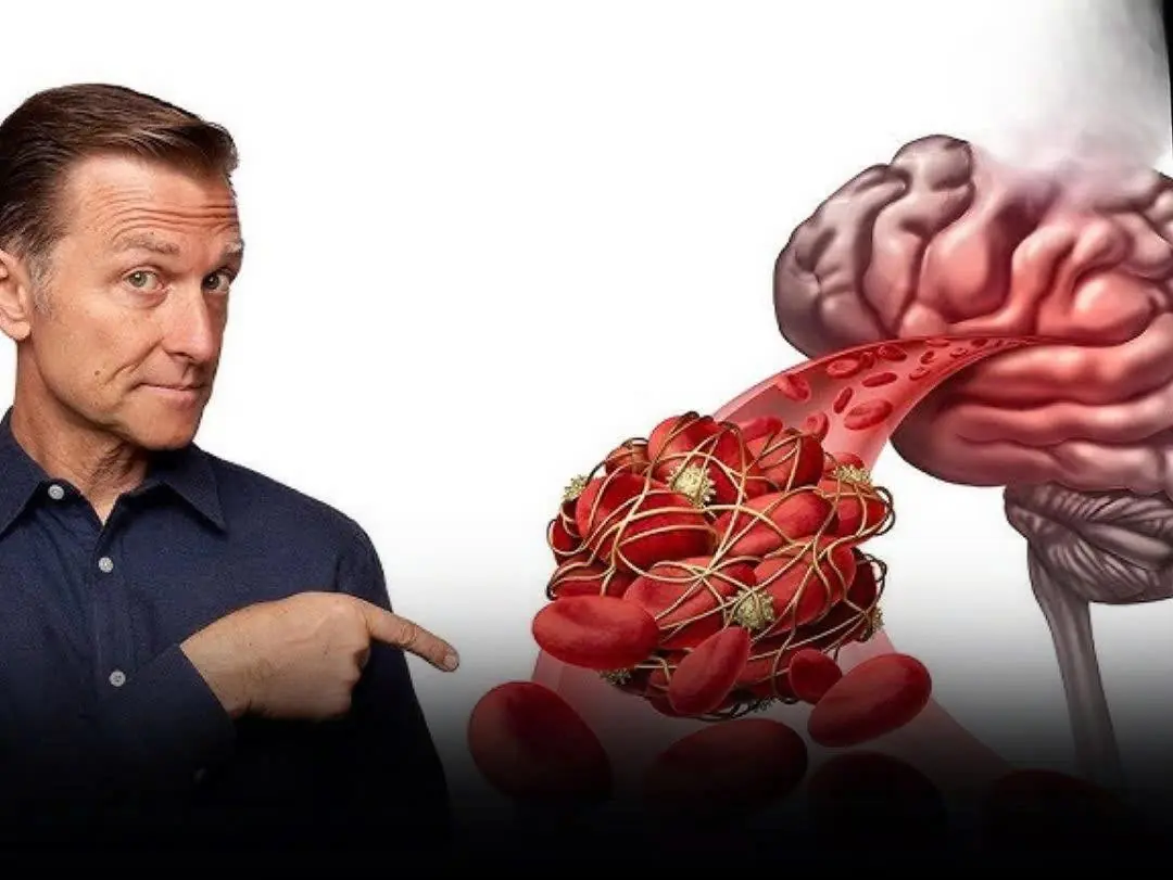 9 Silent Warning Signs of a Brain Blo:od Clot