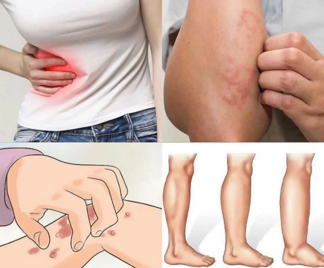 If Your Kidneys Are in Danger, Your Body Will Warn You With These 8 Signs