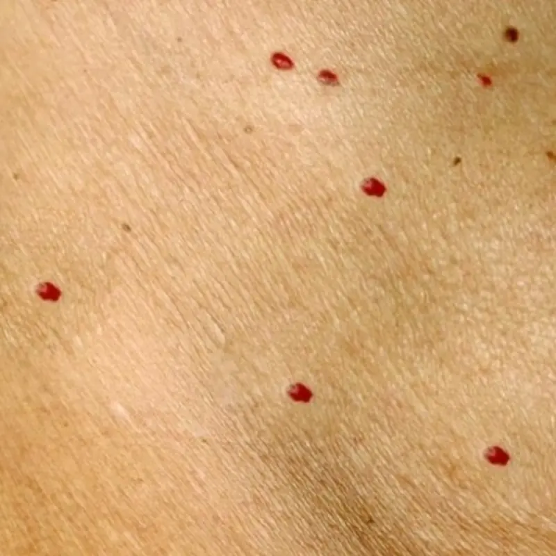 Red Dots on Your Skin: What Your Body May Be Trying to Tell You