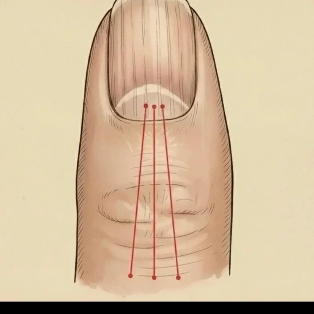 If These Lines Appear on Your Nails After 40, Your Body May Be Sending a Signal