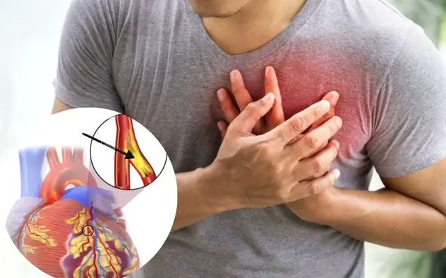 Not Just Chest Pain: 10 Pain Locations That May Signal a Heart Attack Many People Overlook