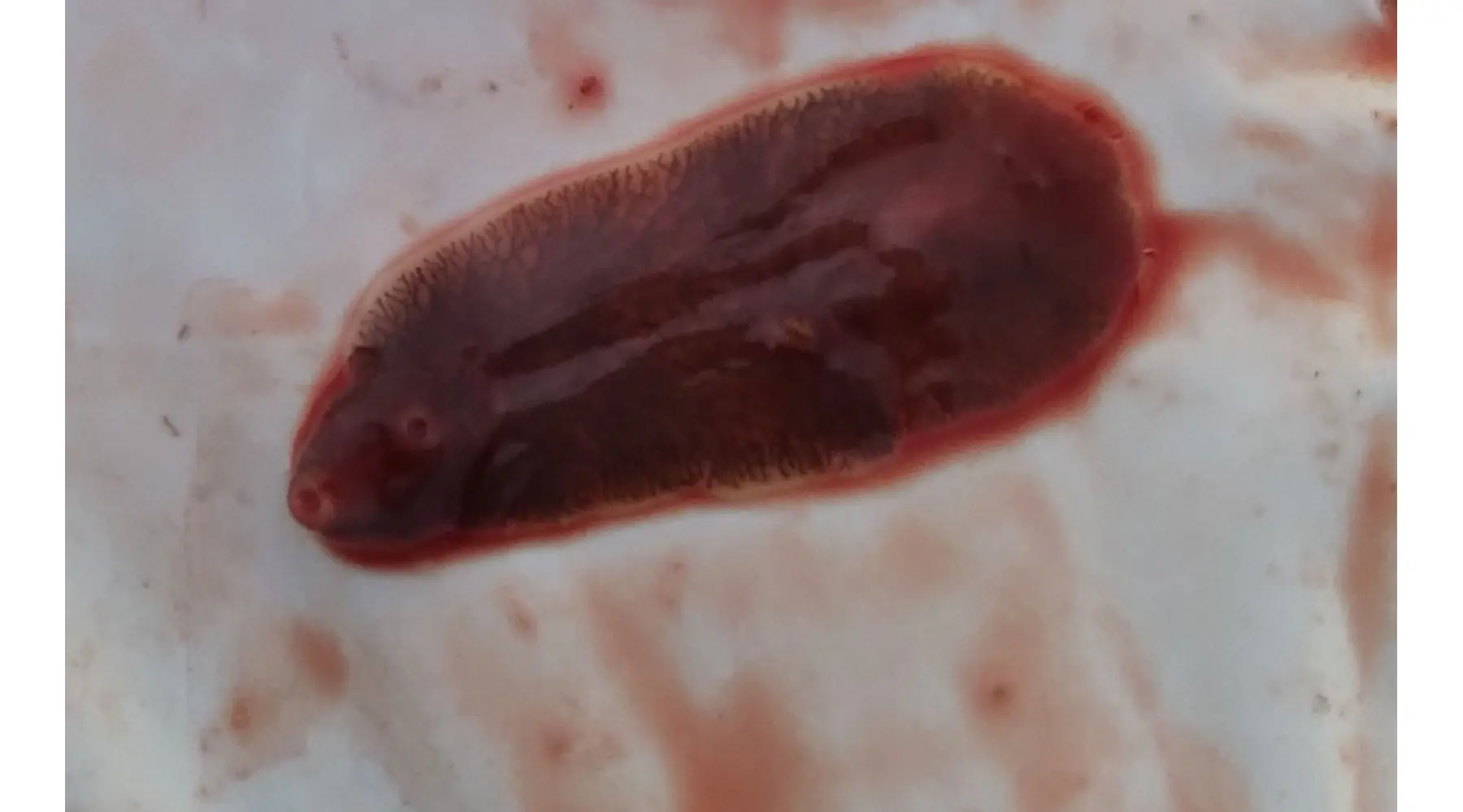 Your Daily Meals Could Be Exposing You to Liver Flukes — Here’s How