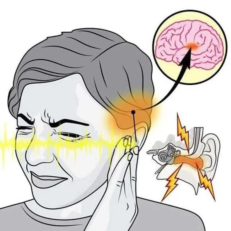 Ringing in Your Ear? What Tinnitus Really Means and When It’s Time to See a Doctor