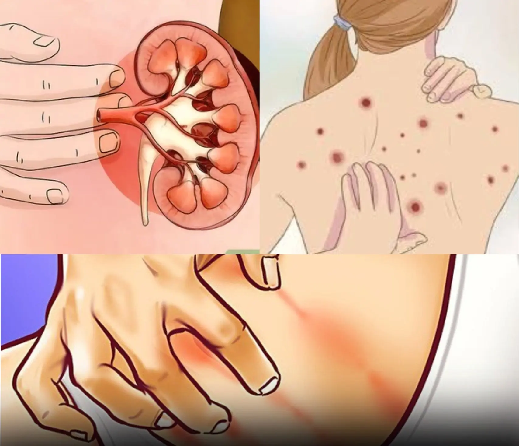 If your kidneys aren't working properly, the body shows these 10 signs