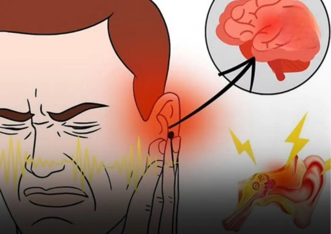 If you hear ringing in your ear, this is a sign that you will suffer from...