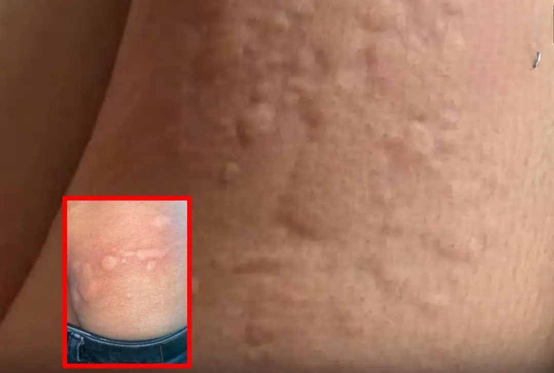 He thought the itching all over his body was an allergic reaction — until doctors discovered the real cause