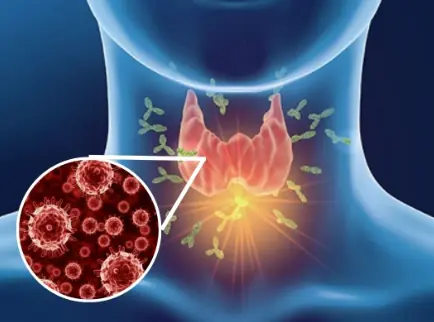35-Year-Old Man’s Sore Throat Turned into Cancer After 5 Chemotherapy Sessions—Doctor Urges: Throw These 2 Things Out of Your Fridge