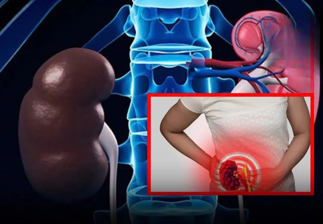 7 Signs Your Kidneys Are Working Well — Check Yourself