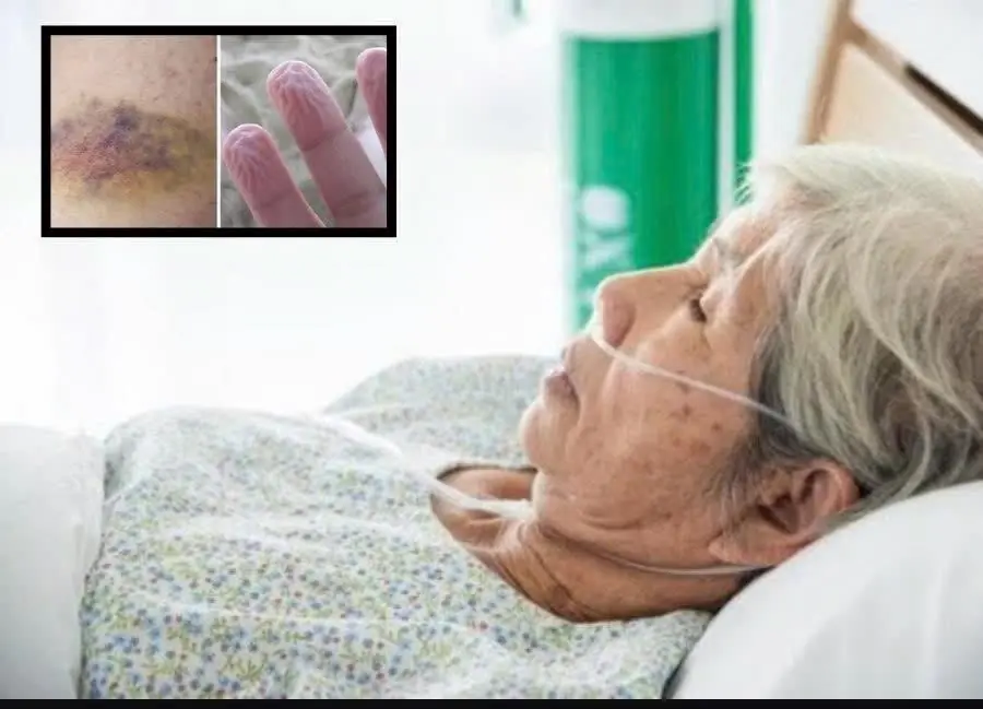 The body rarely goes silent before the end — these 6 warning signs may appear up to a year in advance