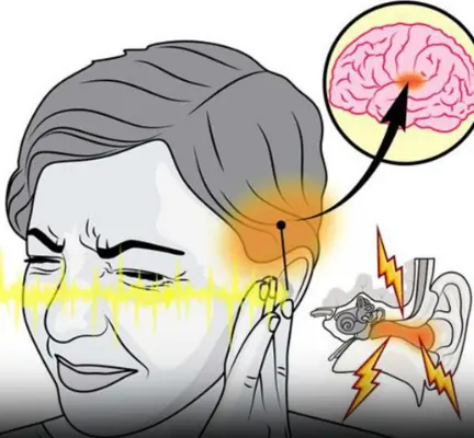Ringing in Your Ear? What Tinnitus Really Means and When to See a Doctor