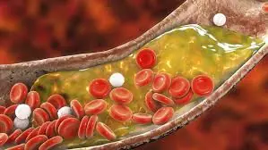 Nighttime Symptoms of Poor Blood Flow in Your Legs and Feet — Don’t Ignore These Signs