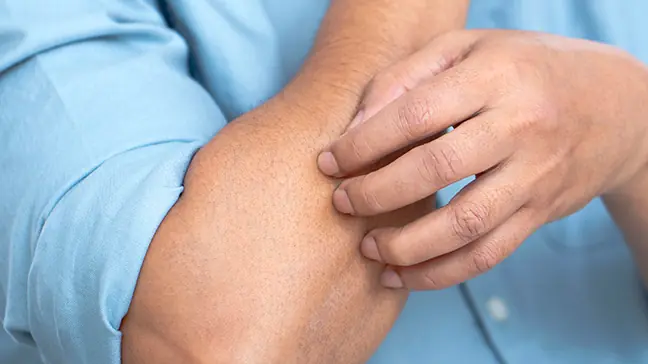 Persistent Itching in Certain Body Areas Could Be a Warning Sign You Shouldn’t Ignore