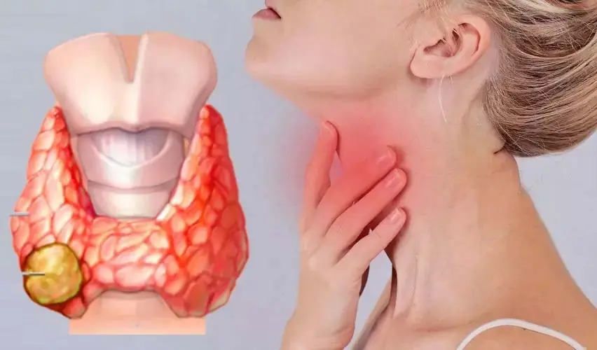 These 5 Subtle Signs Could Be Early Indicators of Thyroid Can.cer