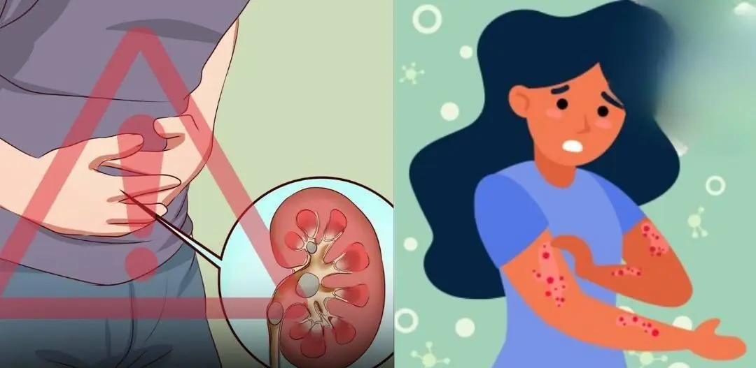 Early Signs of Kid:ney Disease & How to Protect Your Kid:neys