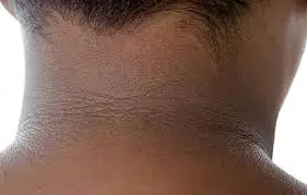 5 Strange Symptoms That Could Point to Diabetes