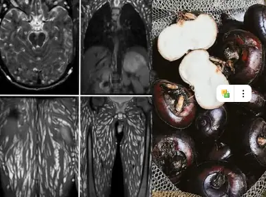 Eating Just One Bite is Already Harmful, But Many Still Eat It Without Worry