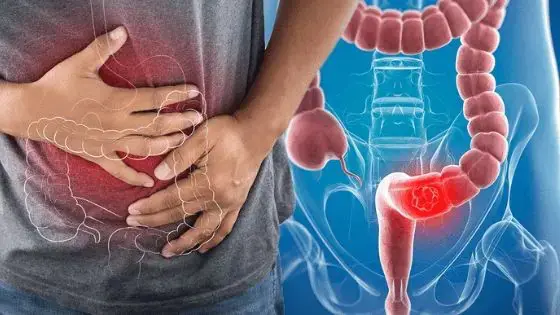 7 Often-Overlooked Signs of Early Colon Can.cer That Deserve Urgent Care
