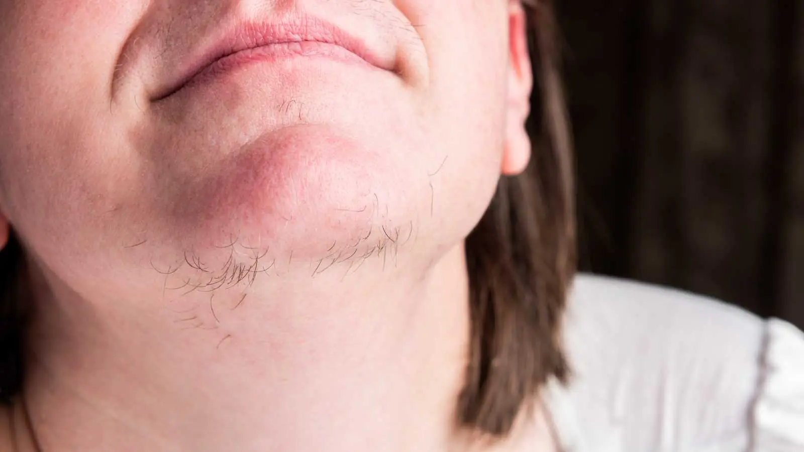 Facial Hair in Women: What Chin Hair Might Say About Your Body