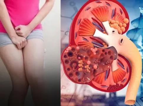 Your Kidneys Are in Trouble If You Notice These Symptoms