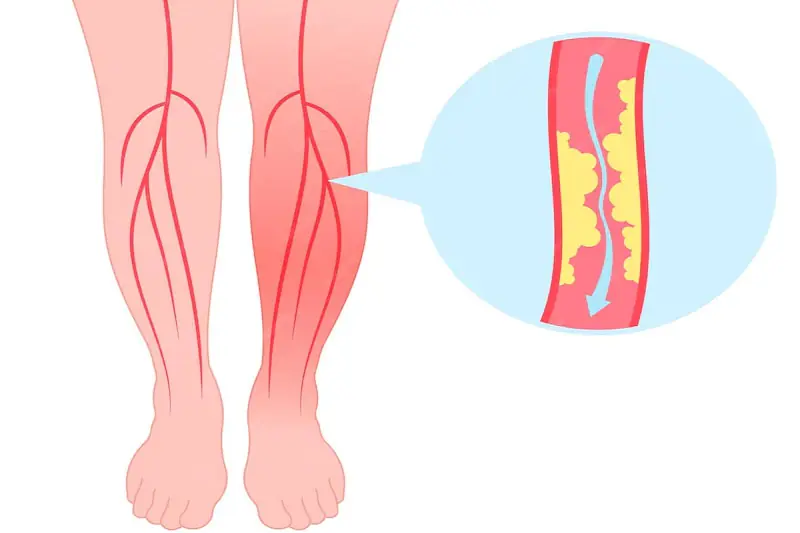 Best 10 Foods to Enhance Leg Circulation Naturally