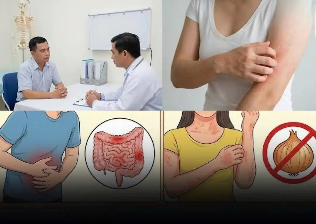 Not Everyone Should Eat Onions: Here’s Who Needs to Be Careful