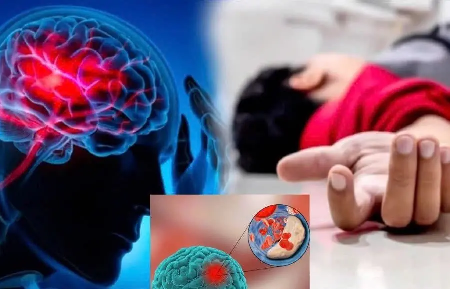 Your body may warn you before a stroke strikes. Spot these 5 signs early—it could save a life.