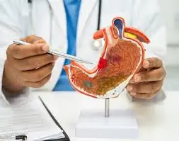 Warning! Early Signs of Stomach Cancer Are Often Overlooked – Check Now