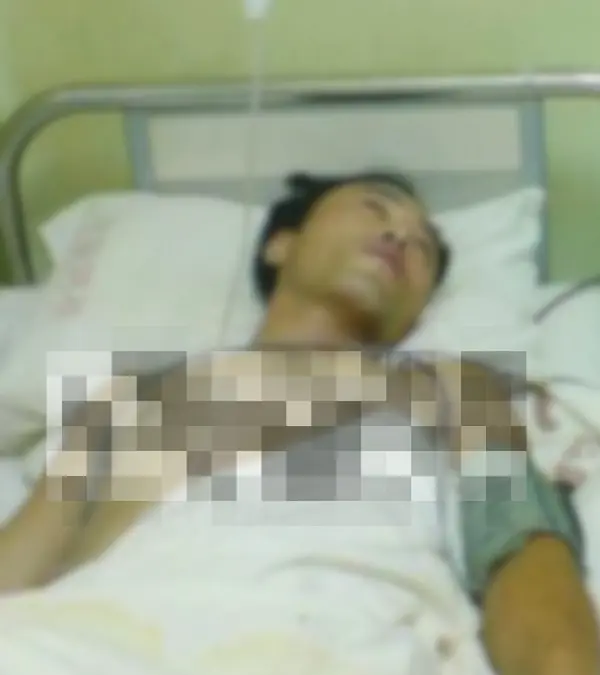 Young people face rising li.ver can.cer rates—doctors warn to limit these 5 beans.