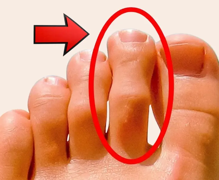 8 Signs That Your Body Needs Help: Warning Signals You Should Never Ignore