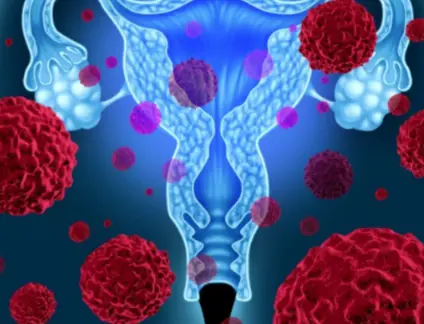 3 Intimate Behaviors That Could Impact Cervical Health