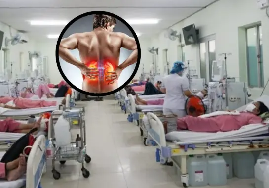 Losing Both Kidneys Before 30: A Wake-Up Call About Kidney Health