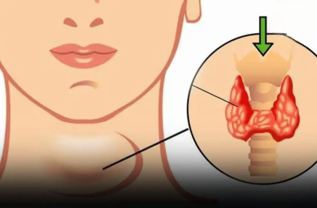 Thyroid Can.cer Warning: 7 Early Body Changes — The First 3 Are Surprisingly Common