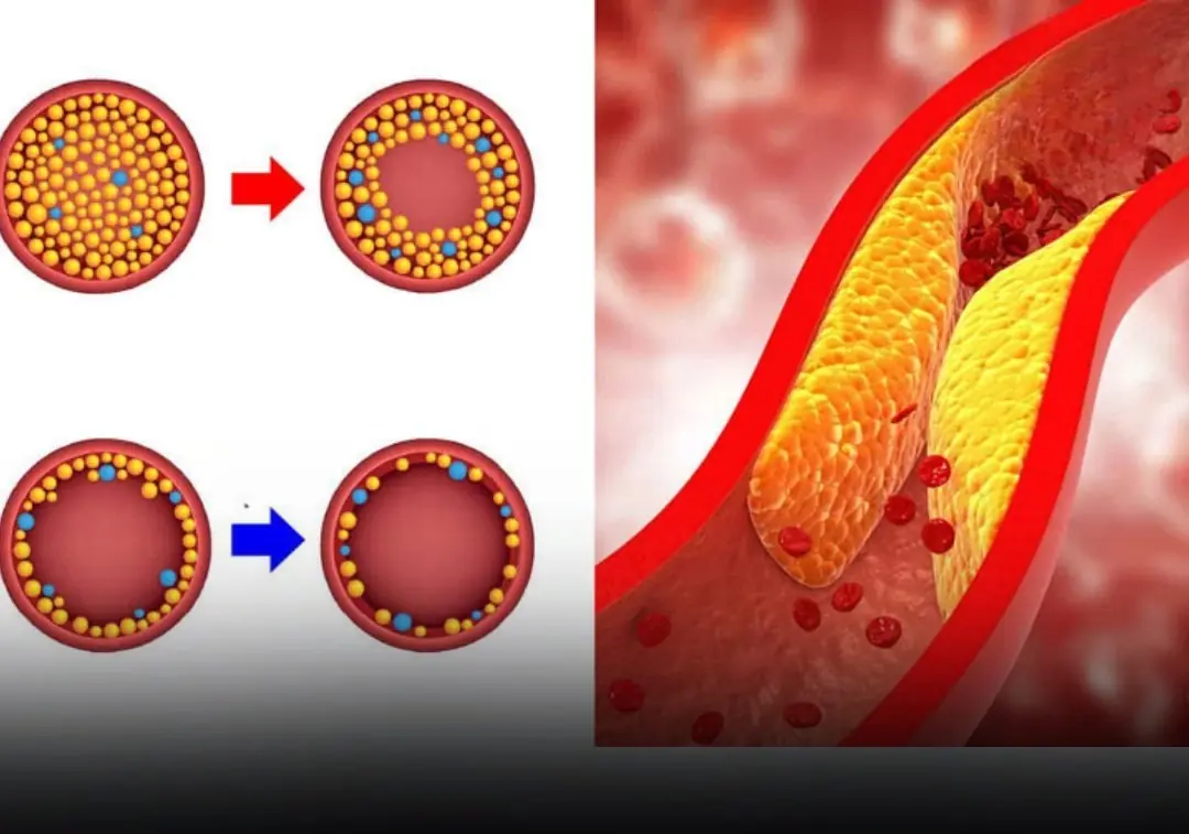 You might not realize it, but certain nighttime symptoms in your feet and legs could signal a heart blockage