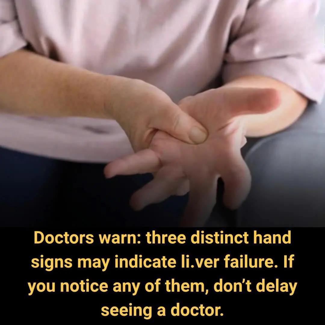Your Hands May Be Warning You About Liver Problems