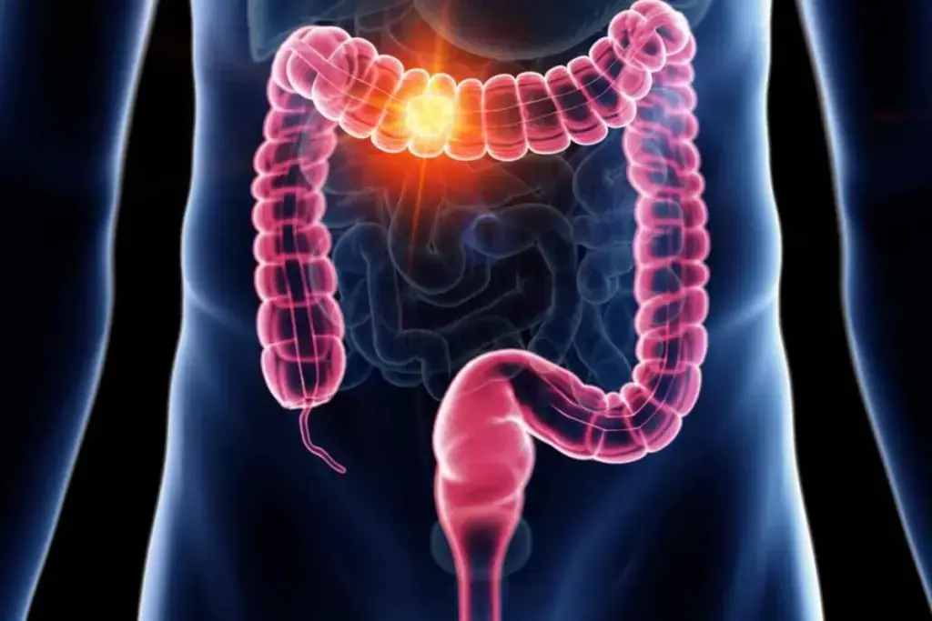 Woman Reveals 5 Colon Can.cer Symptoms That Should Never Be Ignored