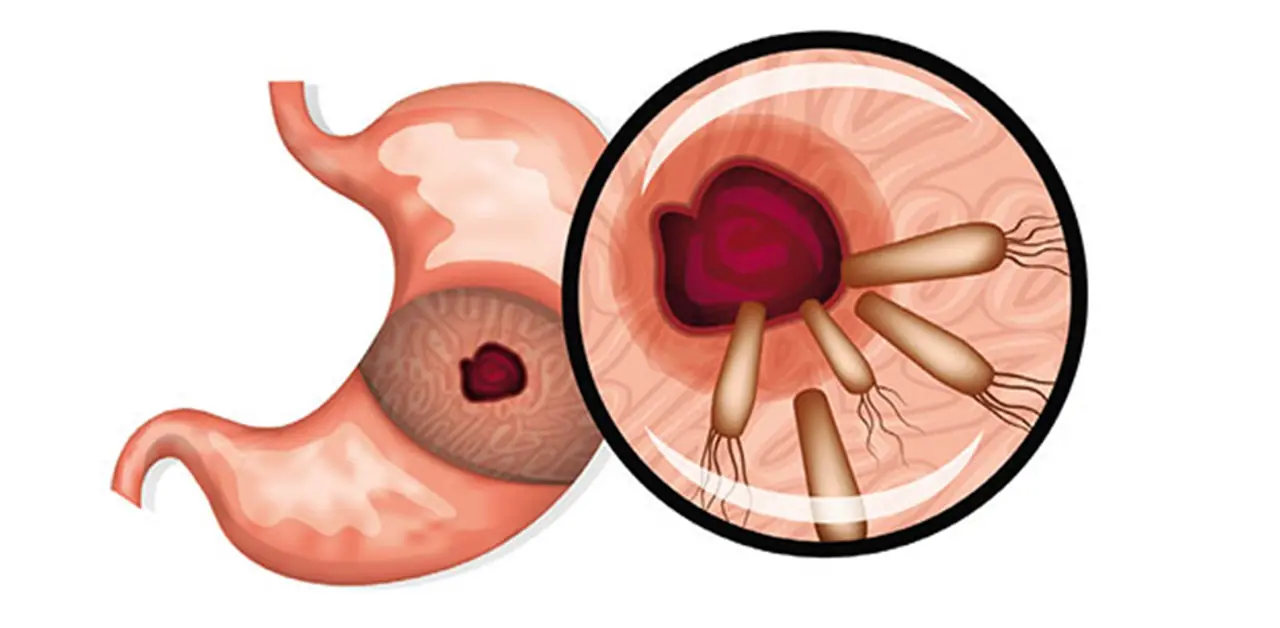 A tragic case: woman passes away from stomach cancer, and doctors point to 3 nighttime habits that could be dangerous