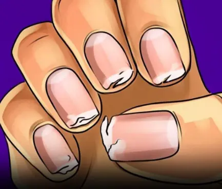 9 Nail Changes You Should Never Ignore