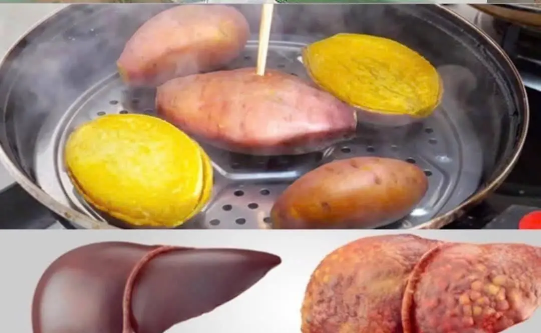 Eating steamed sweet potatoes every day, woman panicked when receiving liver test results
