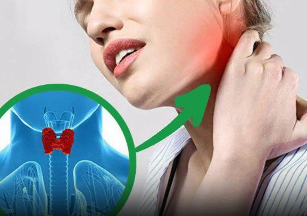 Don’t Miss These Five Early Signs of Thyroid Can:cer