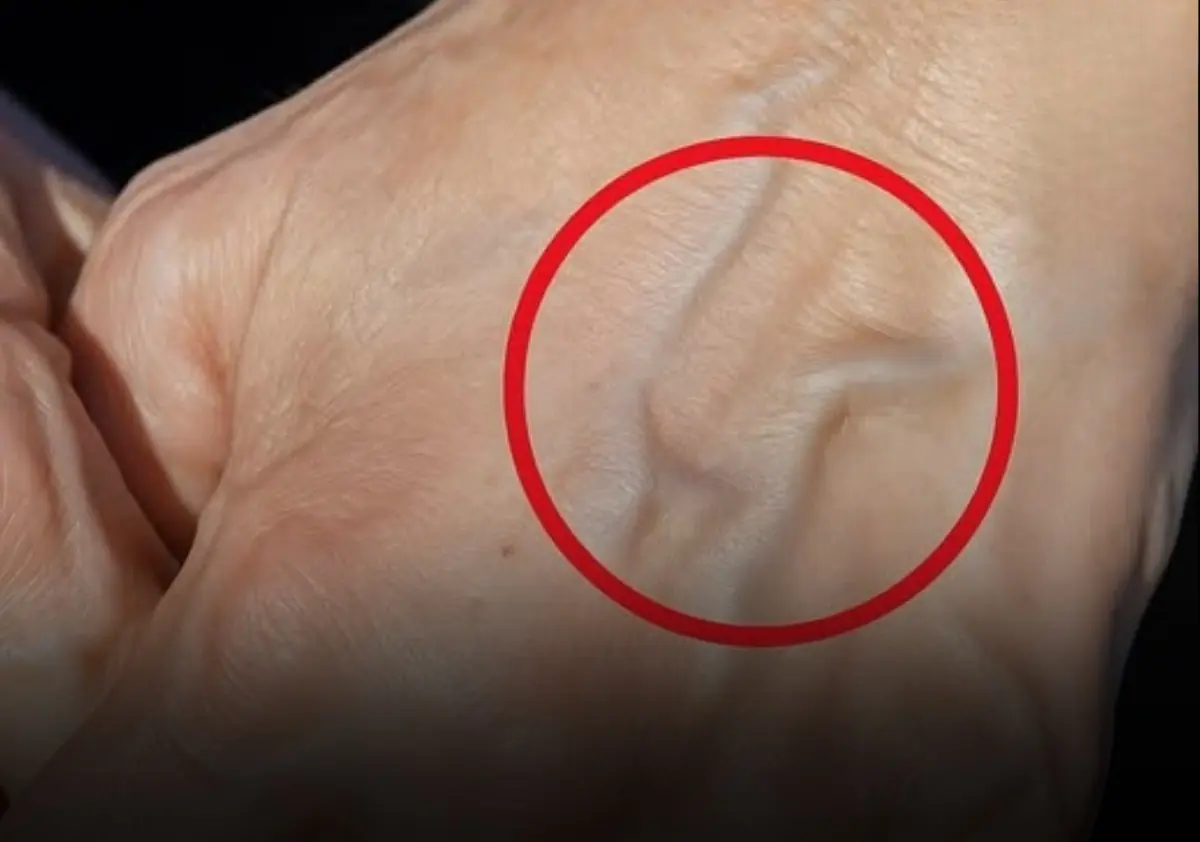 If you have visible veins, it means you are… See more