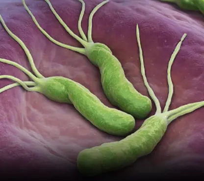 Natural Ways to Manage H. Pylori Without Antibiotics