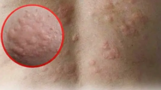 He Thought It Was Just an Allergy… The Diagnosis Shocked Him