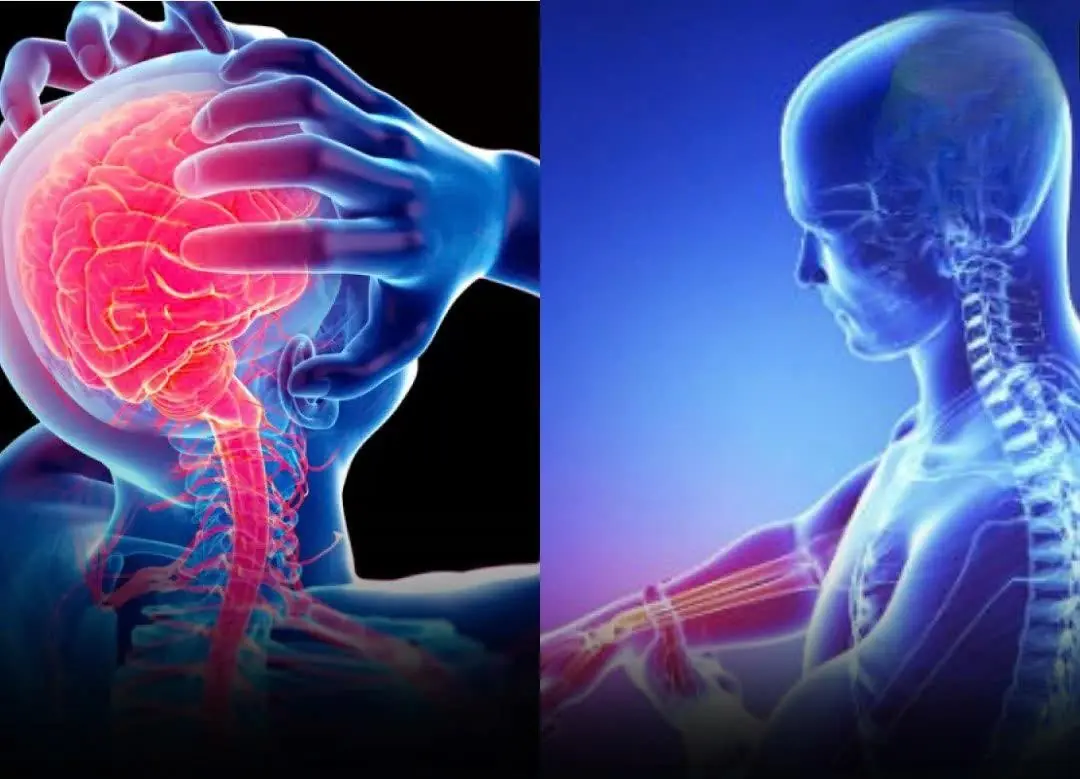 These are the symptoms nearly half of str:oke patients feel days before the att:ack