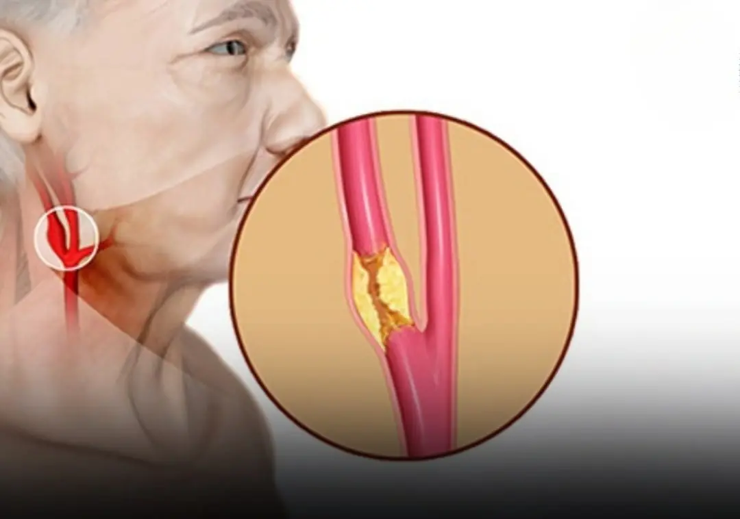 6 Evidence - Based Ways to Support Healthy Arteries