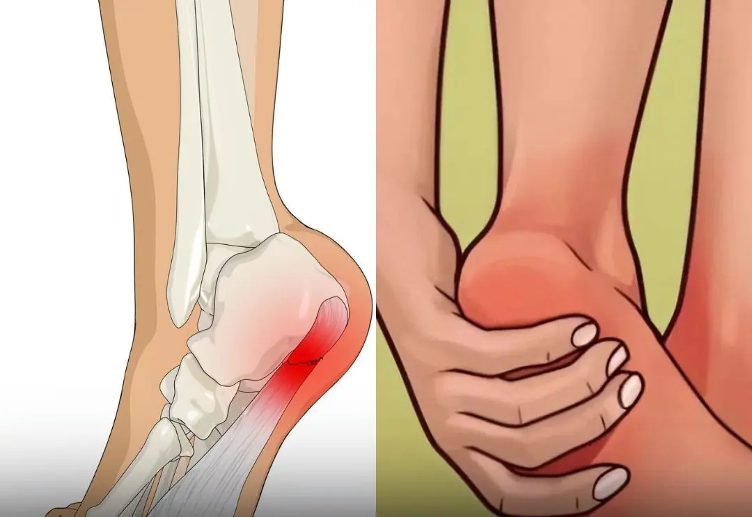 Heel Pain When You Wake Up? Here’s What’s Really Happening to Your Body